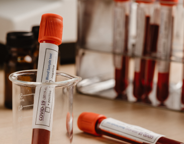 Diagnostic Testing